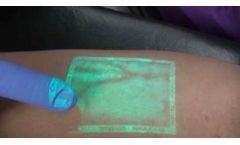 Discover Dr. Kasuo Miyake’s Innovative CLaCS Procedure