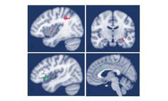 Parasym - Non-Invasive Neuromodulation Device for Mood Enhancement / Neural Modulation with tVNS