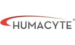 Arteriovenous Fistulae for Haemodialysis: A Systematic Review and Metaanalysis of Efficacy and Safety Outcomes