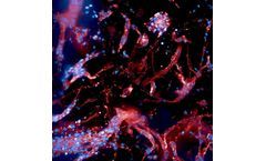 3D bioprinting technology for brain disease
