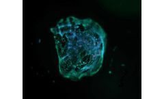 3D bioprinting technology for skin disease