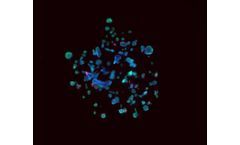 3D bioprinting technology for prostate disease