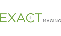 EDAP Announces Exclusive Worldwide Distribution Rights to Exact Imaging’s Micro-Ultrasound Technologies