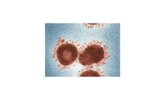 Superfast real-time PCR solutions for COVID-19 detection sector
