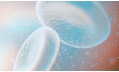 VenoValve - Surgically Implanted Valve for Chronic Venous Disease (CVD)