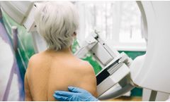 Patient-reported outcomes in oncology sector