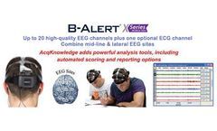 Wireless EEG and Cognitive State Analysis
