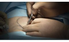 Advanced Wound Matrix for Surgical and Incisional Wound Management