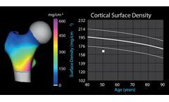 Dual-Energy X-ray Absorptiometry (DXA) Scan Software for Bone Health Assessment