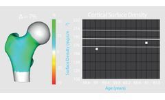 Dual-Energy X-ray Absorptiometry (DXA) Scan Software for Treatment Response Monitoring
