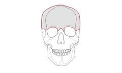 Custom Implant for Protocol Neurosurgery