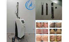 What is CO2 Fractional Laser Treatment