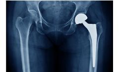 Titanium for Medical