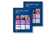 Head and Neck Tumours