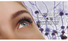 Mitigating Ocular Infection Risks in the Workplace and the Importance of Eye Protection