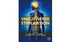Vagus Nerve Stimulation