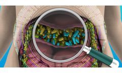 Human Intestinal Ecosystem Analysis